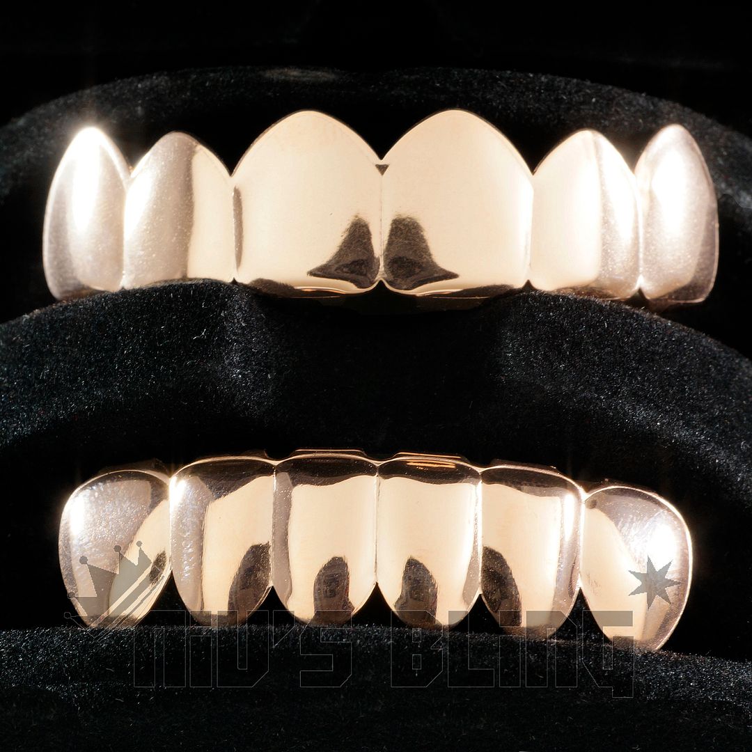 18K Rose Gold IP Plated GRILLZ Top & Bottom Tooth Hip Hop STAINLESS